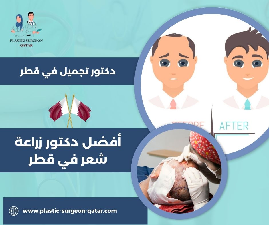 أفضل دكتور زراعة شعر في قطر أفضل دكتور زراعة شعر في قطر