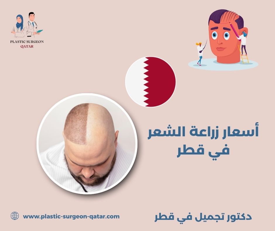 زراعة الشعر في قطر زراعة الشعر في قطر