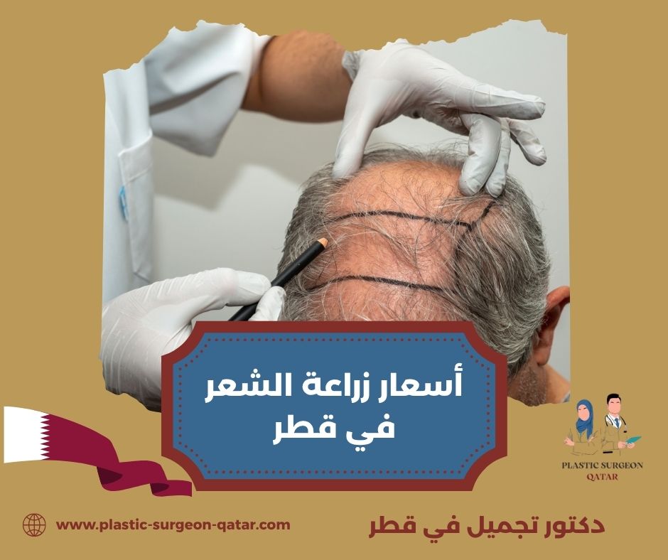اسعار زراعة الشعر في قطر اسعار زراعة الشعر في قطر