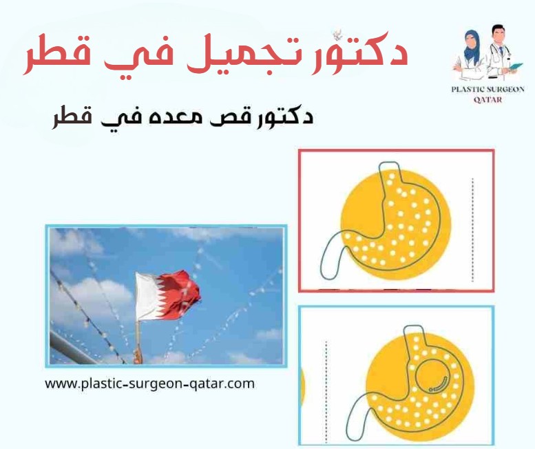 دكتور قص معده في قطر