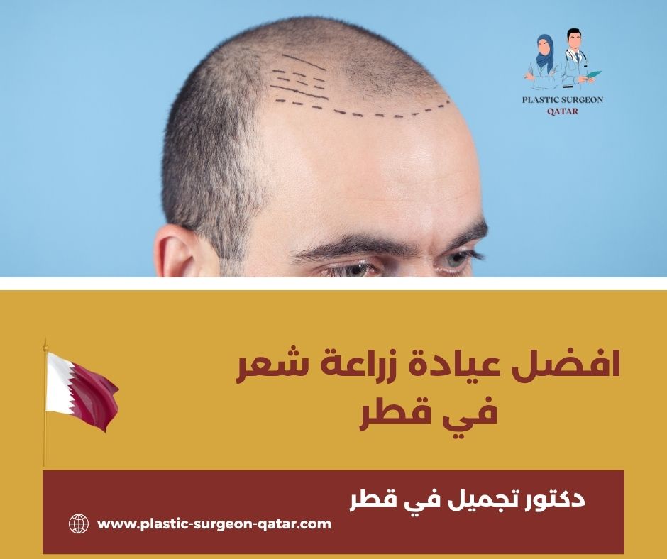 عيادة زراعة الشعر في قطر