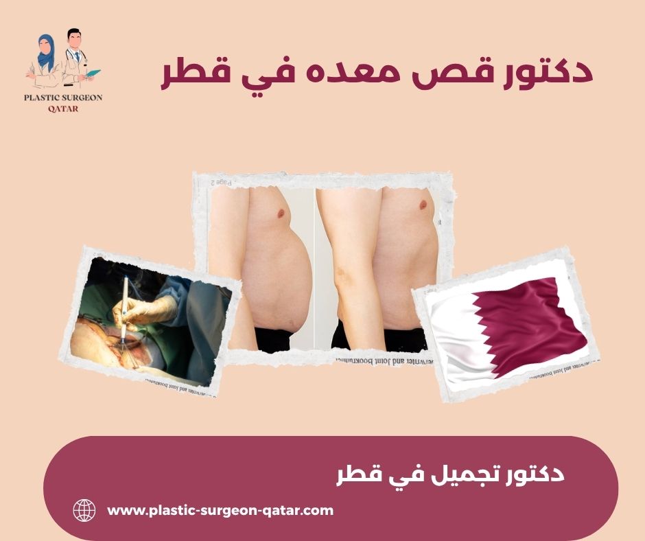 دكتور قص معده قطر دكتور قص معده قطر
