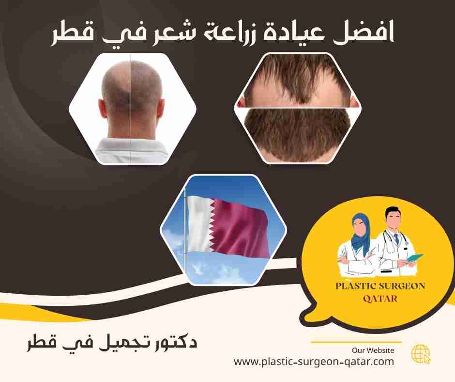 افضل عيادة زراعة شعر في قطر