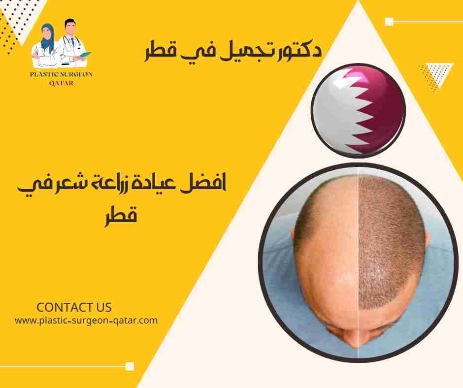 افضل عيادة زراعة شعر في قطر