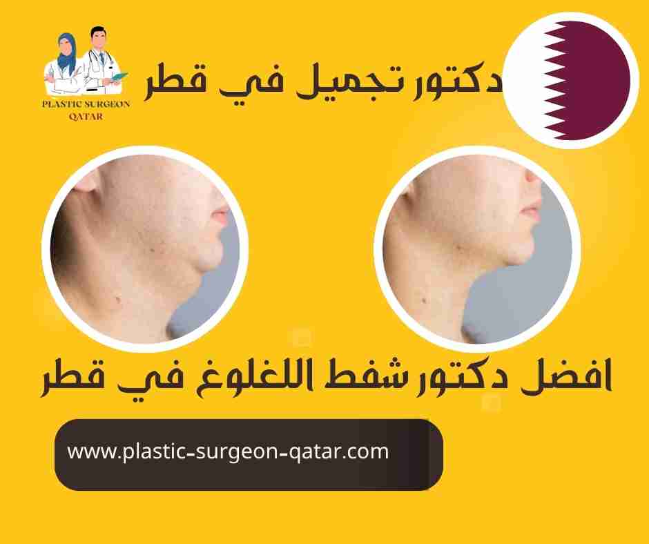 افضل دكتور شفط اللغلوغ في قطر