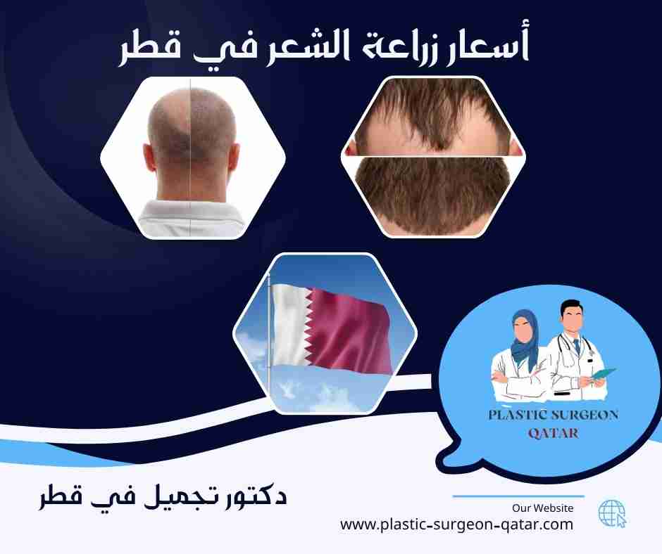 أسعار زراعة الشعر في قطر