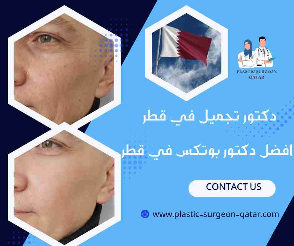 افضل دكتور بوتكس في قطر