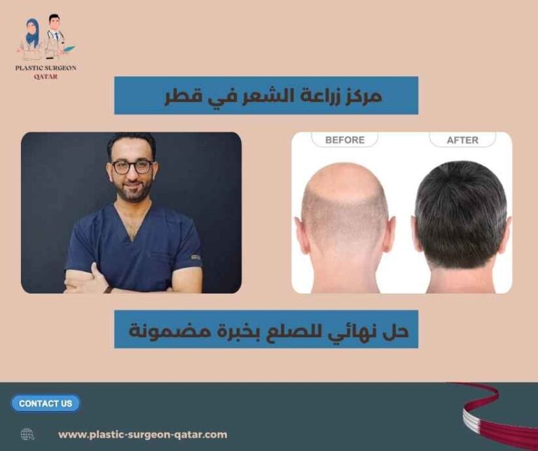 مركز زراعة الشعر في قطر