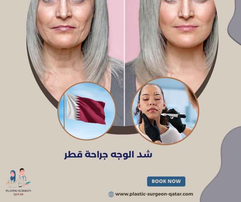 شد الوجه جراحة قطر
