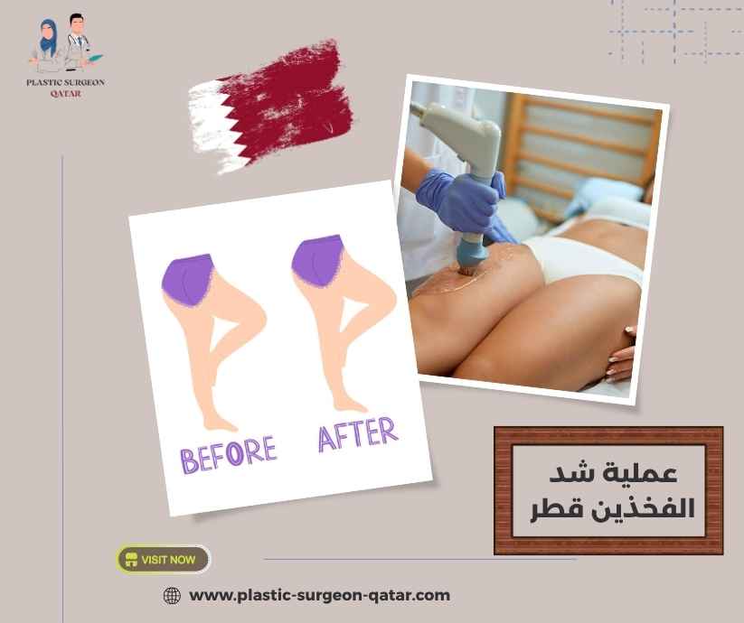 عملية شد الفخذين قطر