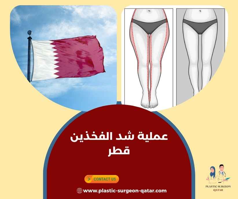 عملية شد الفخذين قطر