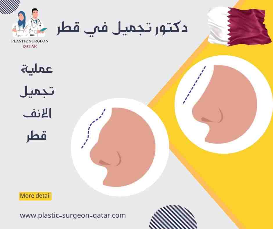 عملية تجميل الانف قطر
