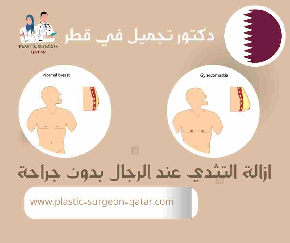 ازالة التثدي عند الرجال بدون جراحة