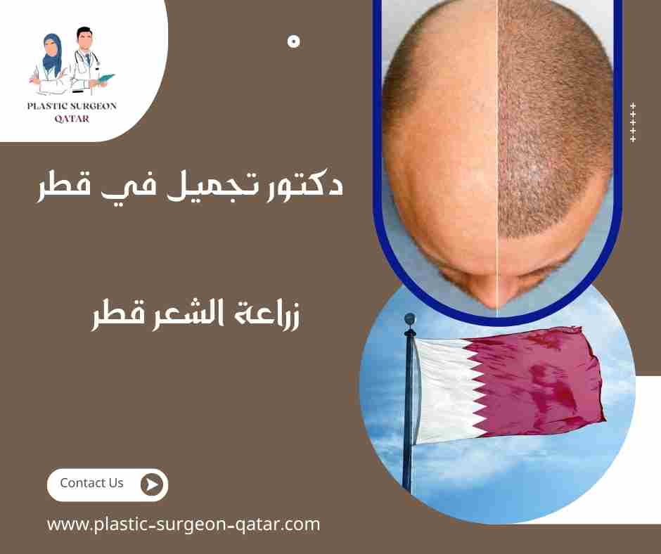 زراعة الشعر قطر