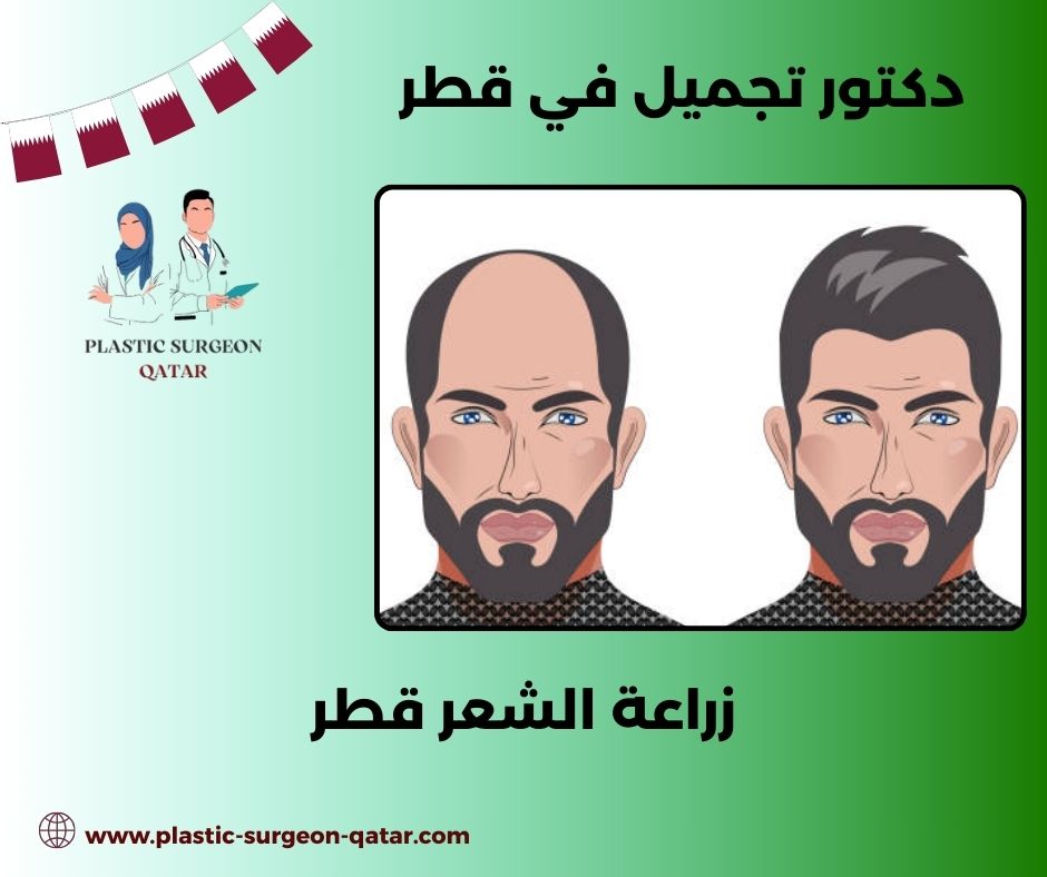 زراعة الشعر قطر