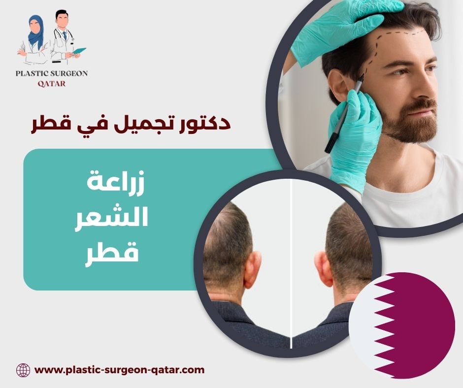 زراعة شعر قطر