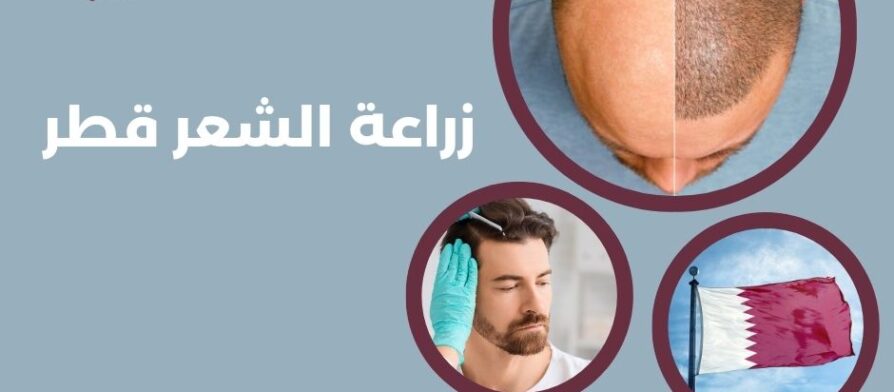 زراعة الشعر قطر