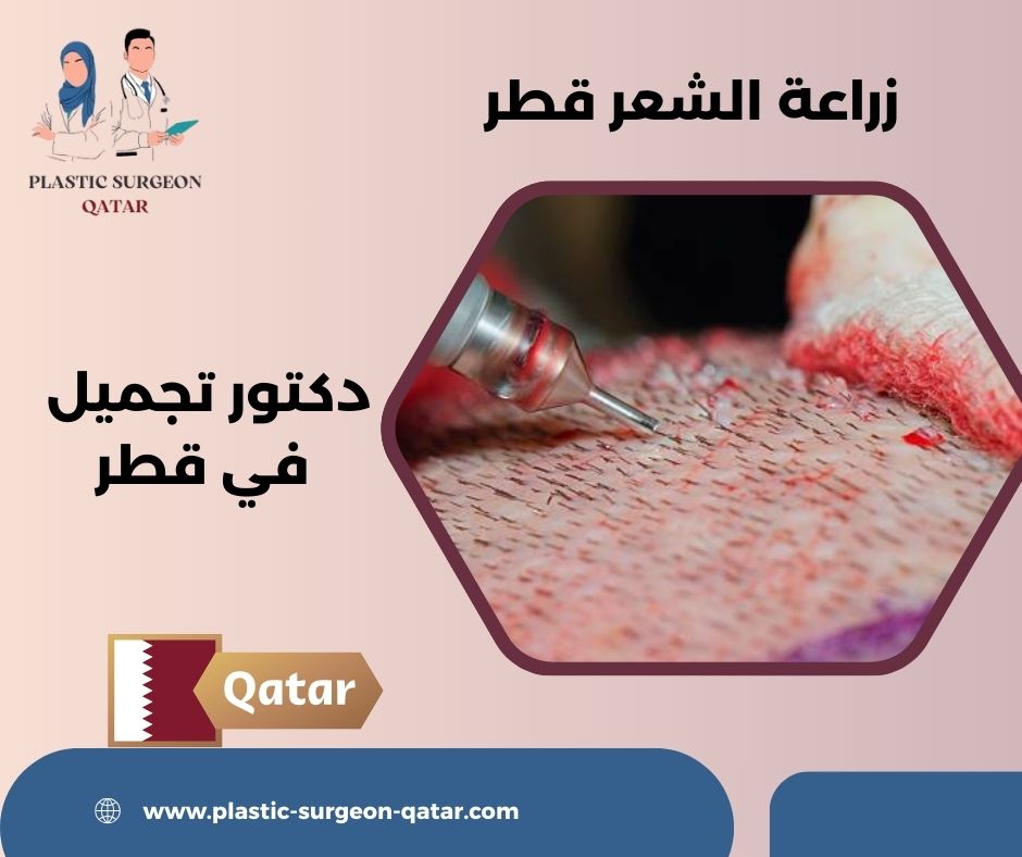 تكلفة زراعة الشعر قطر