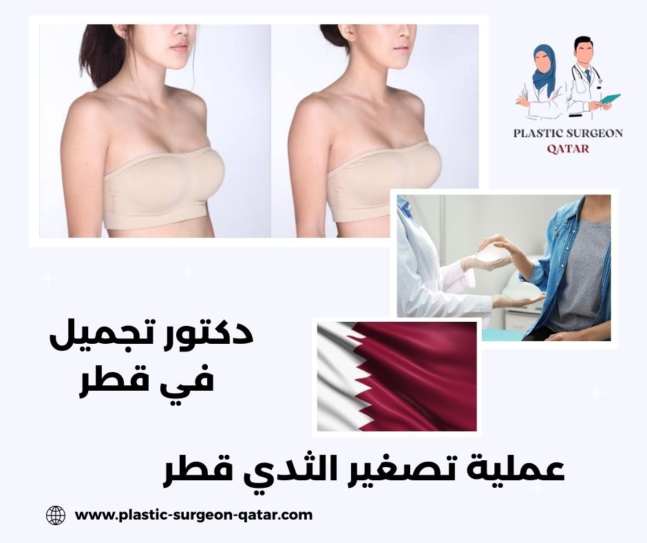 عملية التثدي قطر