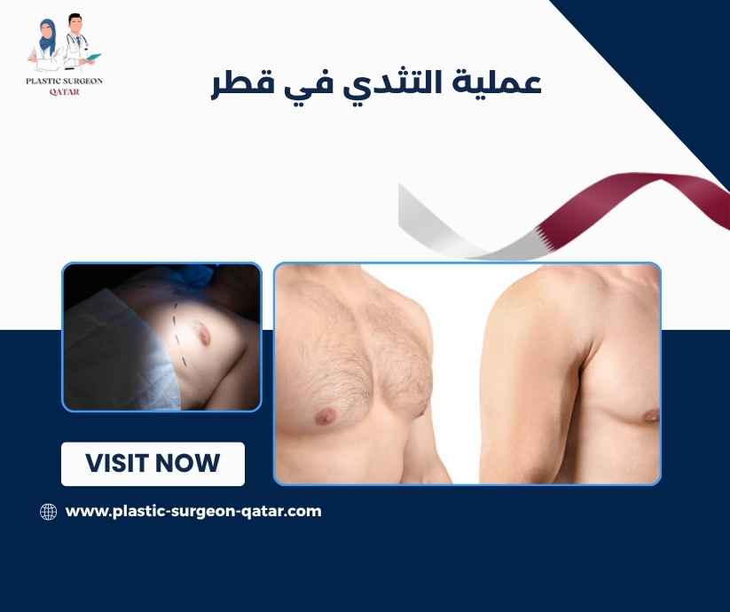 عملية التثدي في قطر
