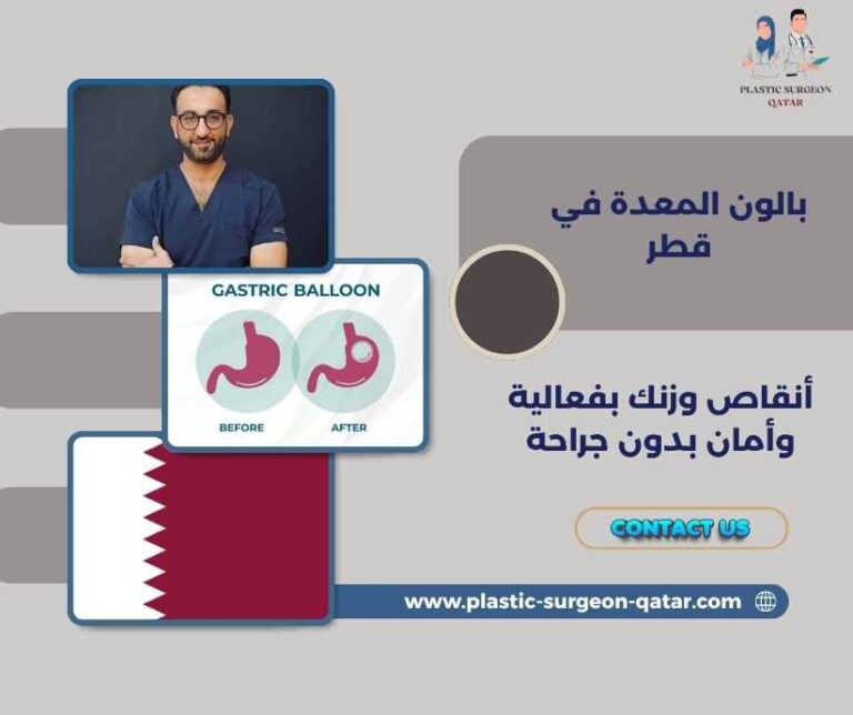 بالون المعدة في قطر
