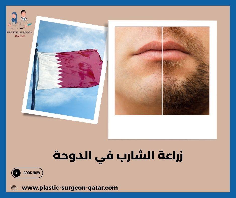 زراعة الشارب في الدوحة