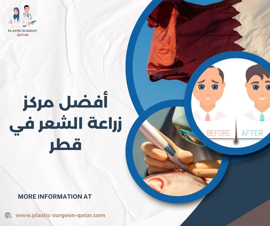 أفضل مركز زراعة الشعر في قطر 