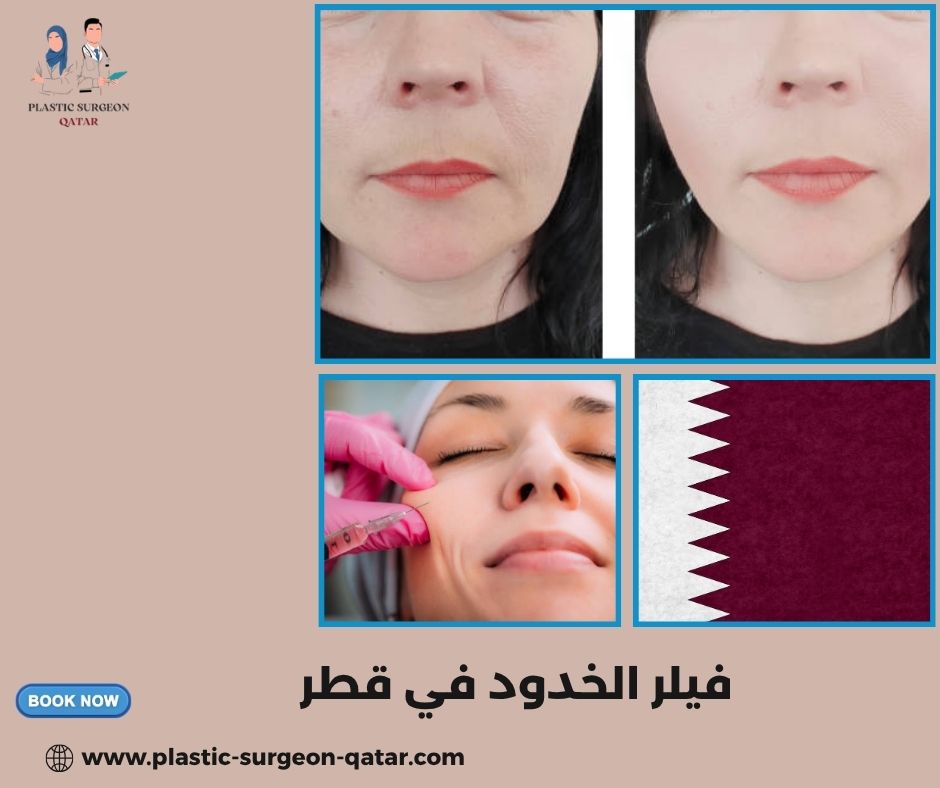 فيلر الخدود في قطر فيلر الخدود في قطر