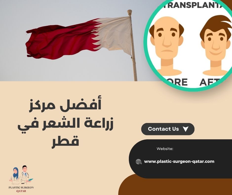 أفضل مركز زراعة الشعر في قطر 