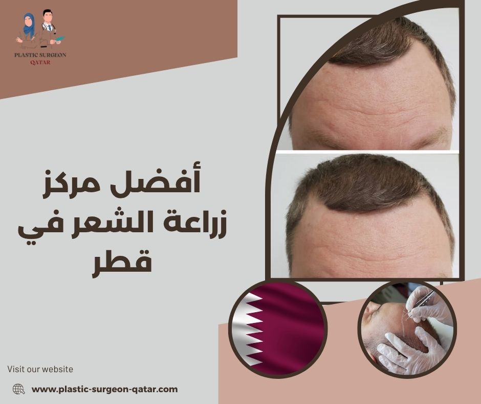 أفضل مركز زراعة الشعر في قطر 