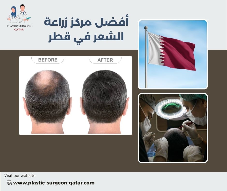 أفضل مركز زراعة الشعر في قطر 