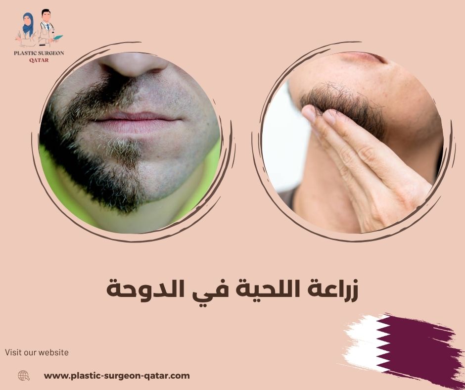 تأثير المناخ القطري على نتائج زراعة اللحية تأثير المناخ القطري على نتائج زراعة اللحية