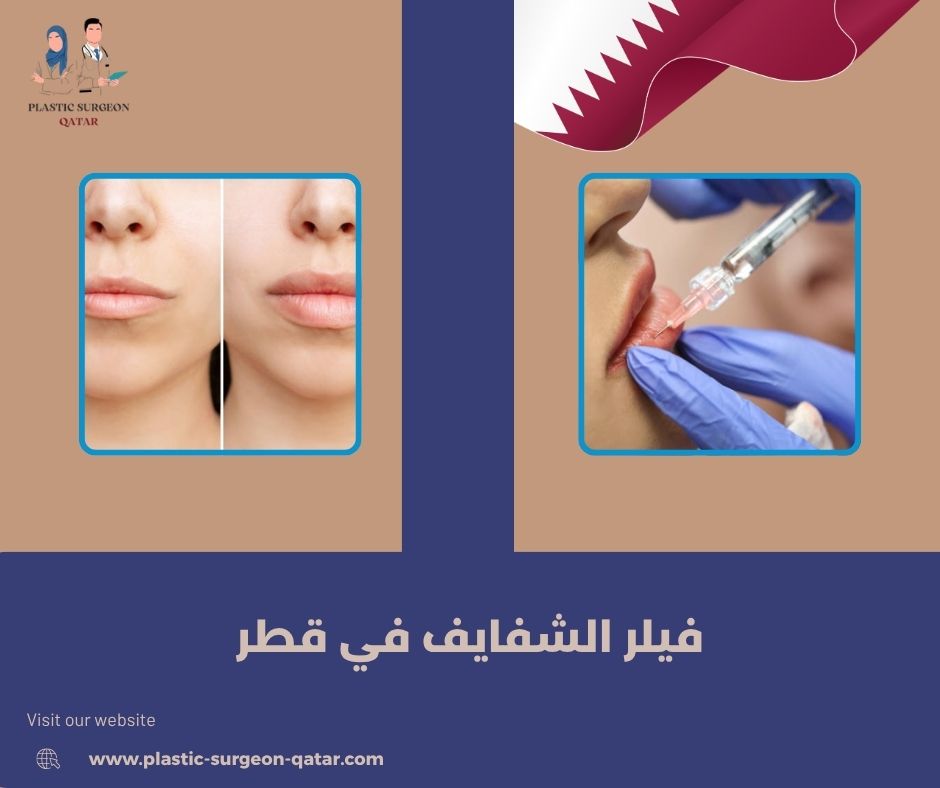 فيلر الشفايف في قطر فيلر الشفايف في قطر