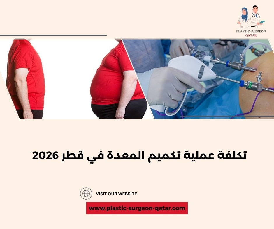 تكلفة عملية تكميم المعدة في قطر 2026