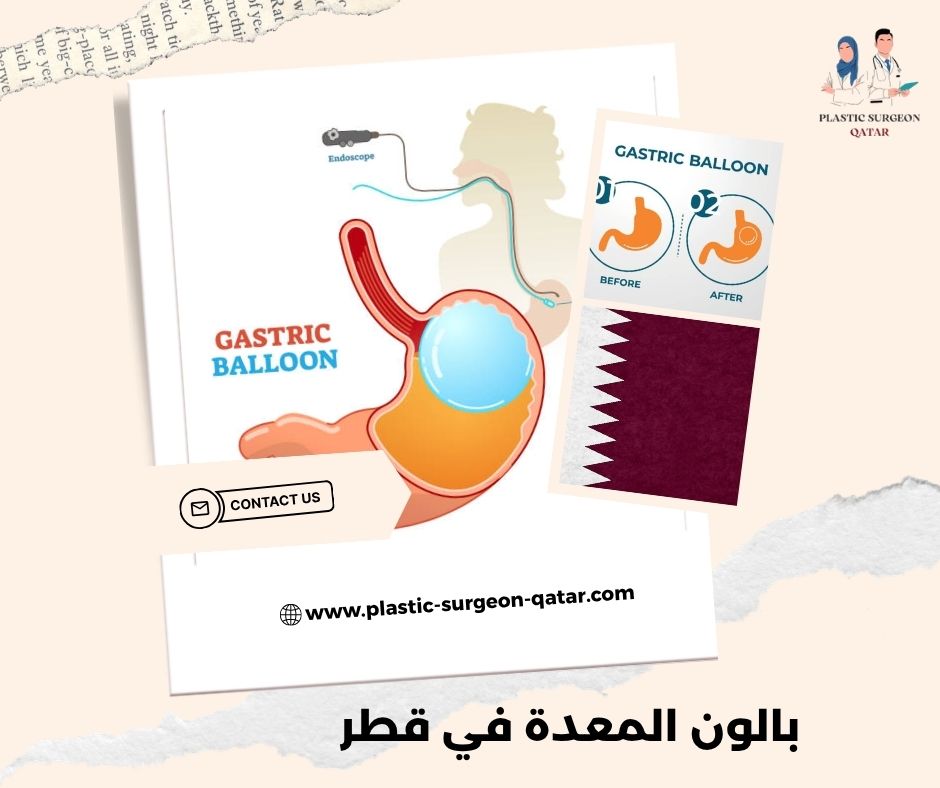 بالون المعدة في قطر بالون المعدة في قطر