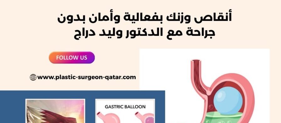 بالون المعدة في قطر