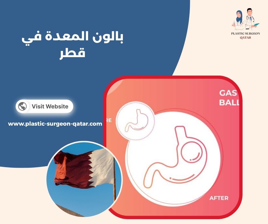 بالون المعدة في قطر بالون المعدة في قطر