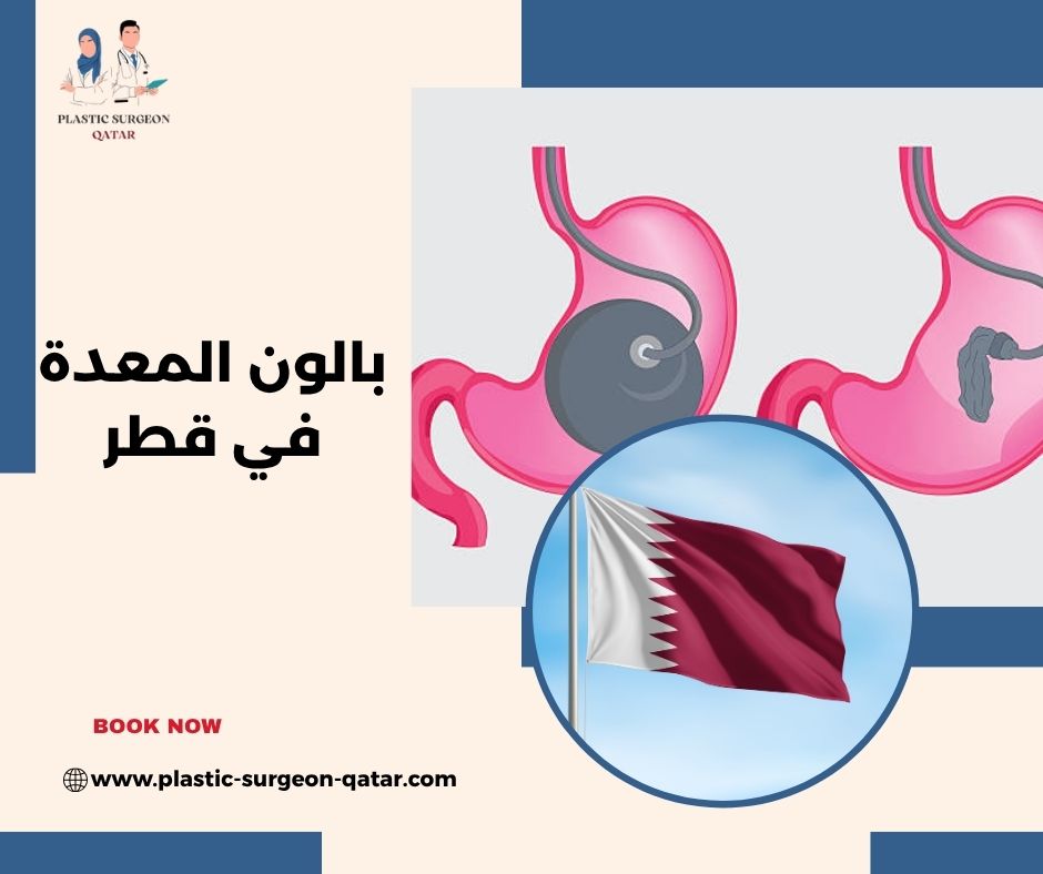 بالون المعدة في قطر بالون المعدة في قطر