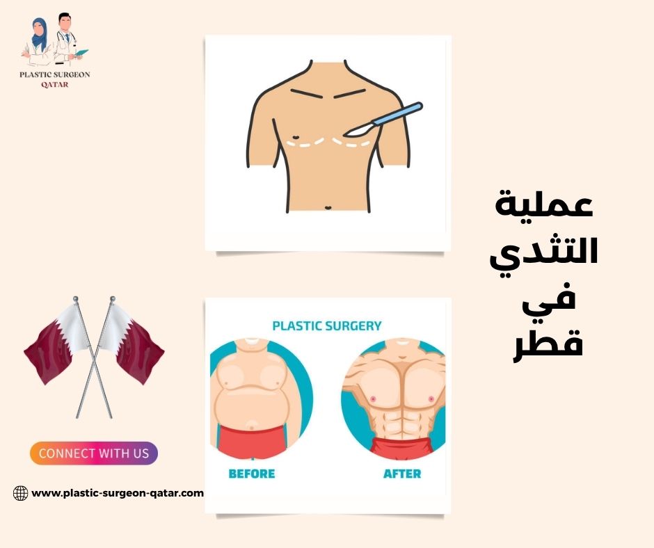 عملية التثدي في قطر عملية التثدي في قطر