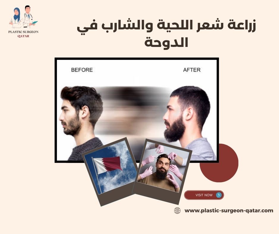 زراعة شعر اللحية والشارب في الدوحة زراعة شعر اللحية والشارب في الدوحة