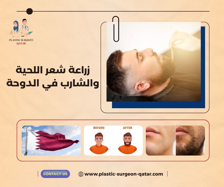 زراعة شعر اللحية والشارب في الدوحة زراعة شعر اللحية والشارب في الدوحة