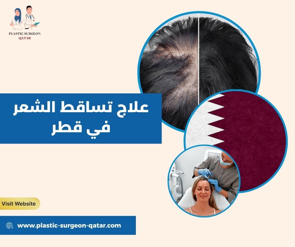 علاج تساقط الشعر في قطر