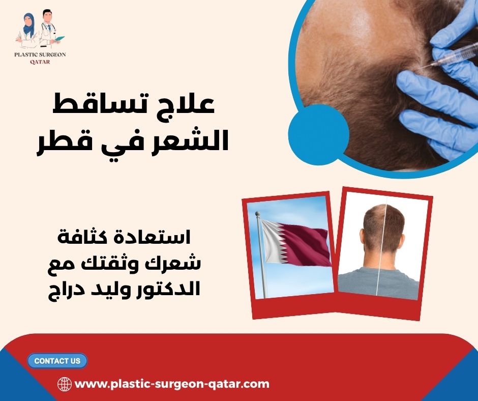 علاج تساقط الشعر في قطر