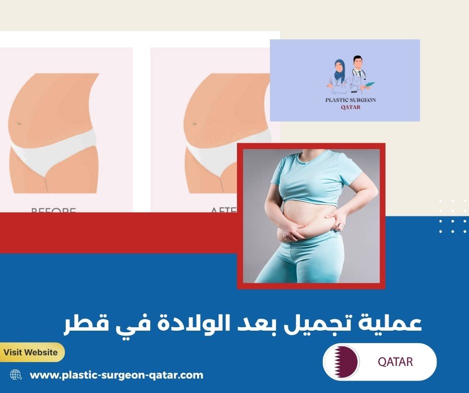 عملية تجميل بعد الولادة في قطر