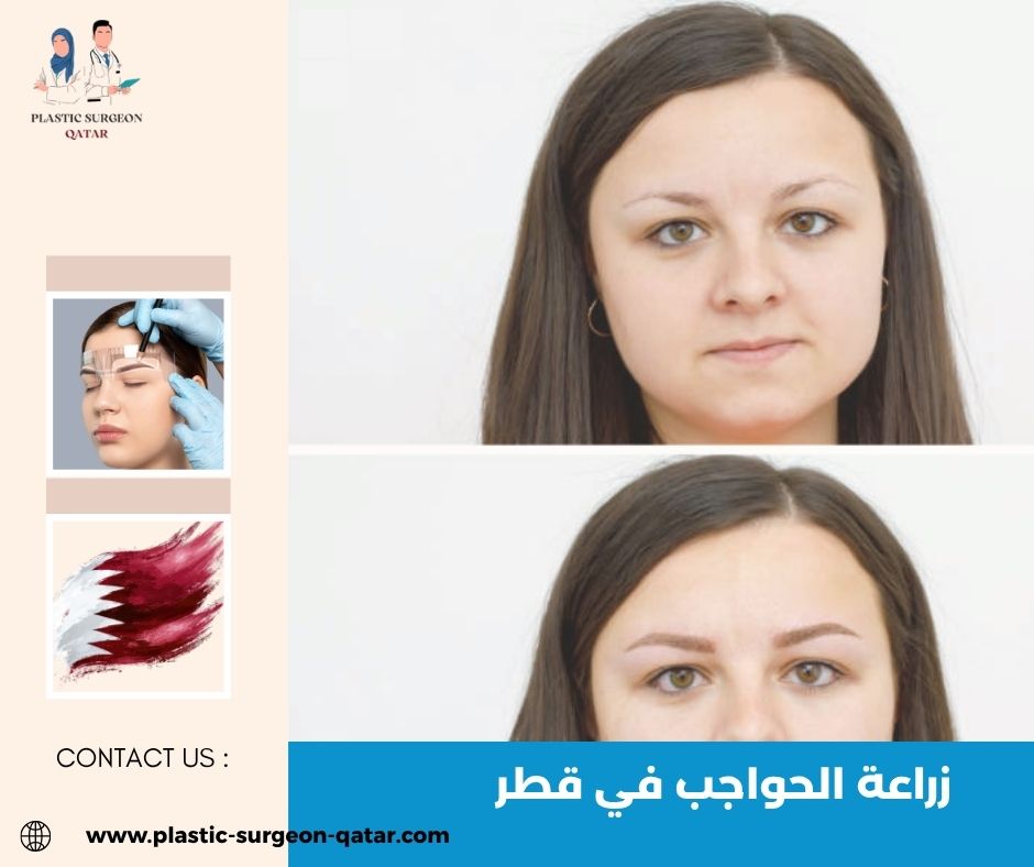 زراعة الحواجب في قطر