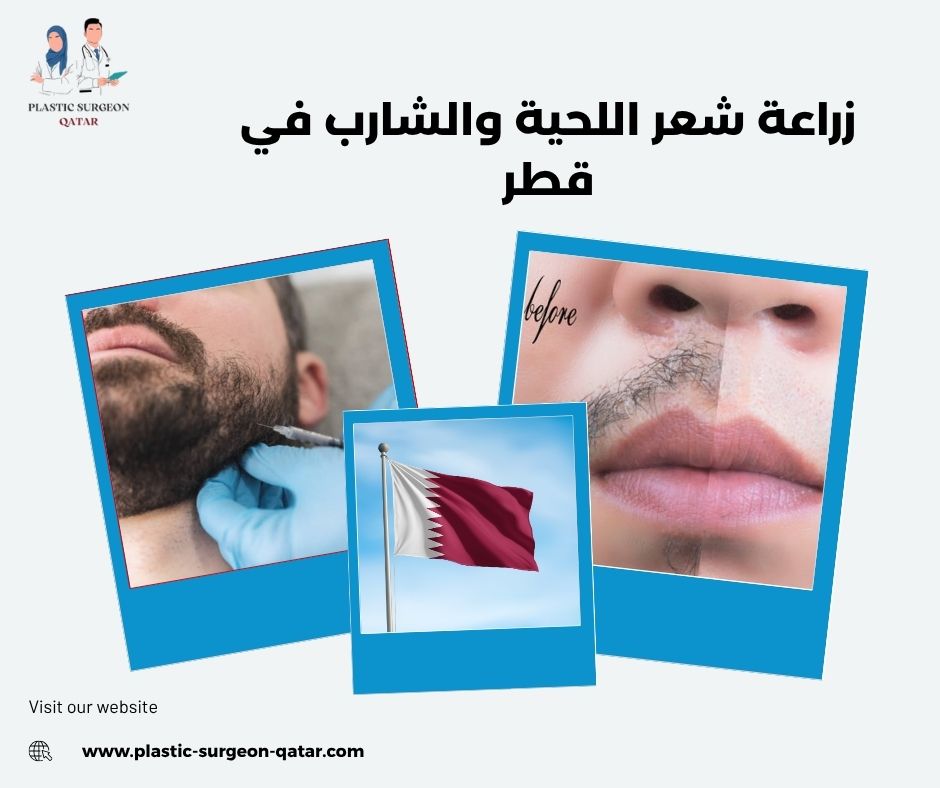 زراعة شعر اللحية والشارب في قطر زراعة شعر اللحية والشارب في قطر