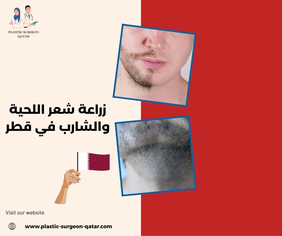 زراعة شعر اللحية والشارب في قطر زراعة شعر اللحية والشارب في قطر