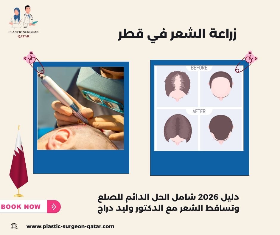 زراعة الشعر في قطر