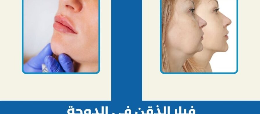 فيلر الذقن في الدوحة