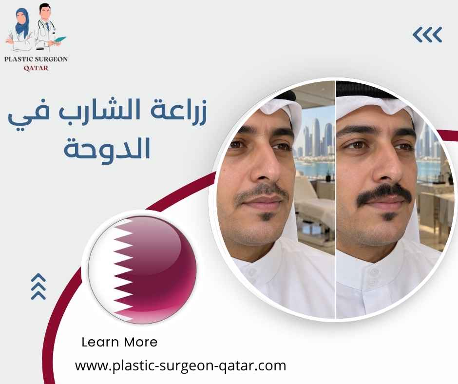 زراعة الشارب في الدوحة زراعة الشارب في الدوحة